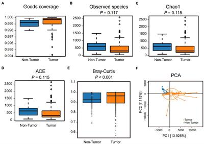 Streptococcus pneumoniae promotes migration and invasion of A549 cells in vitro by activating mTORC2/AKT through up-regulation of DDIT4 expression